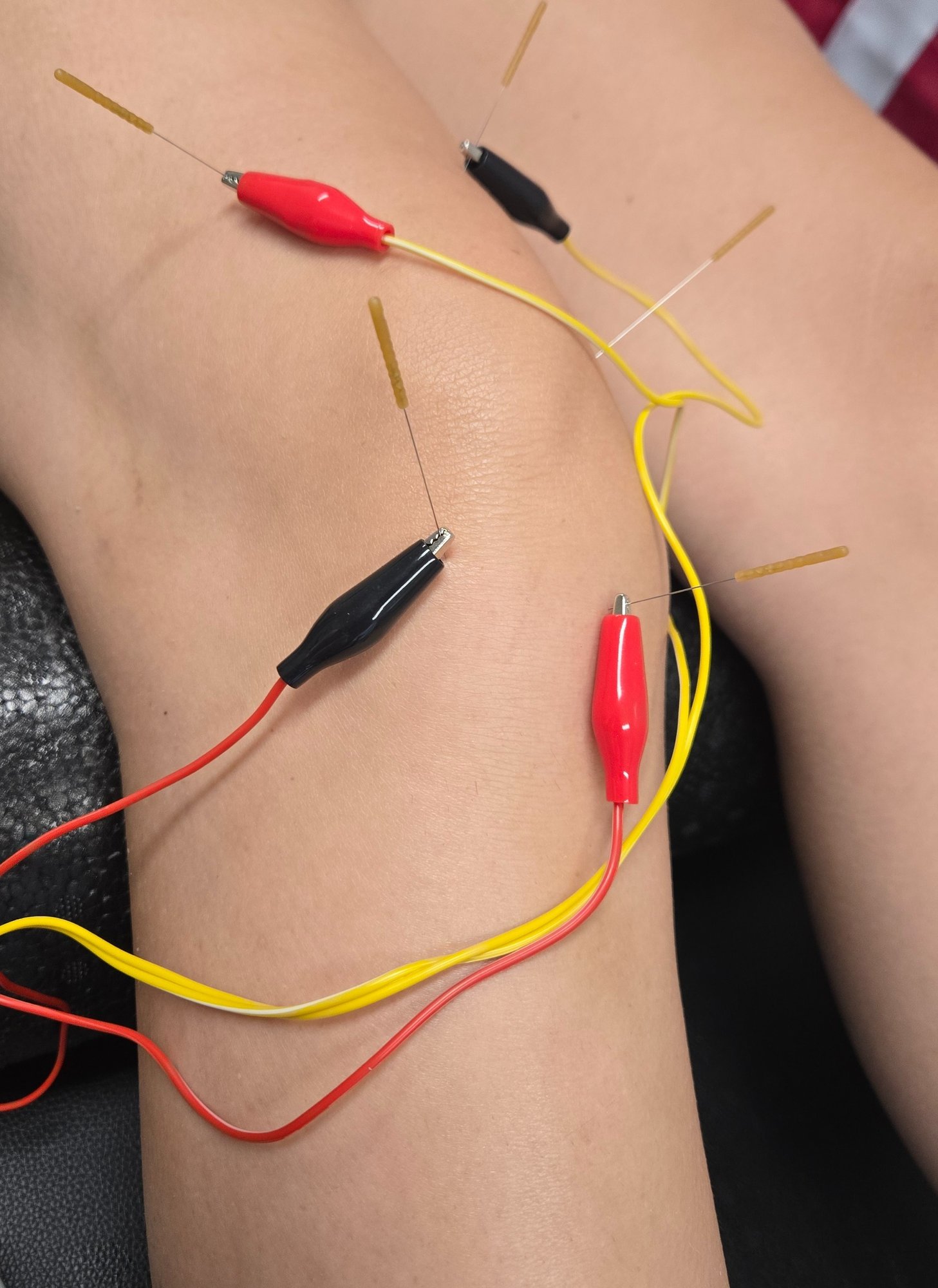 Running Physical Therapy